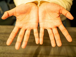 手相のしわが多い人は神経質・せっかちなタイプ？
